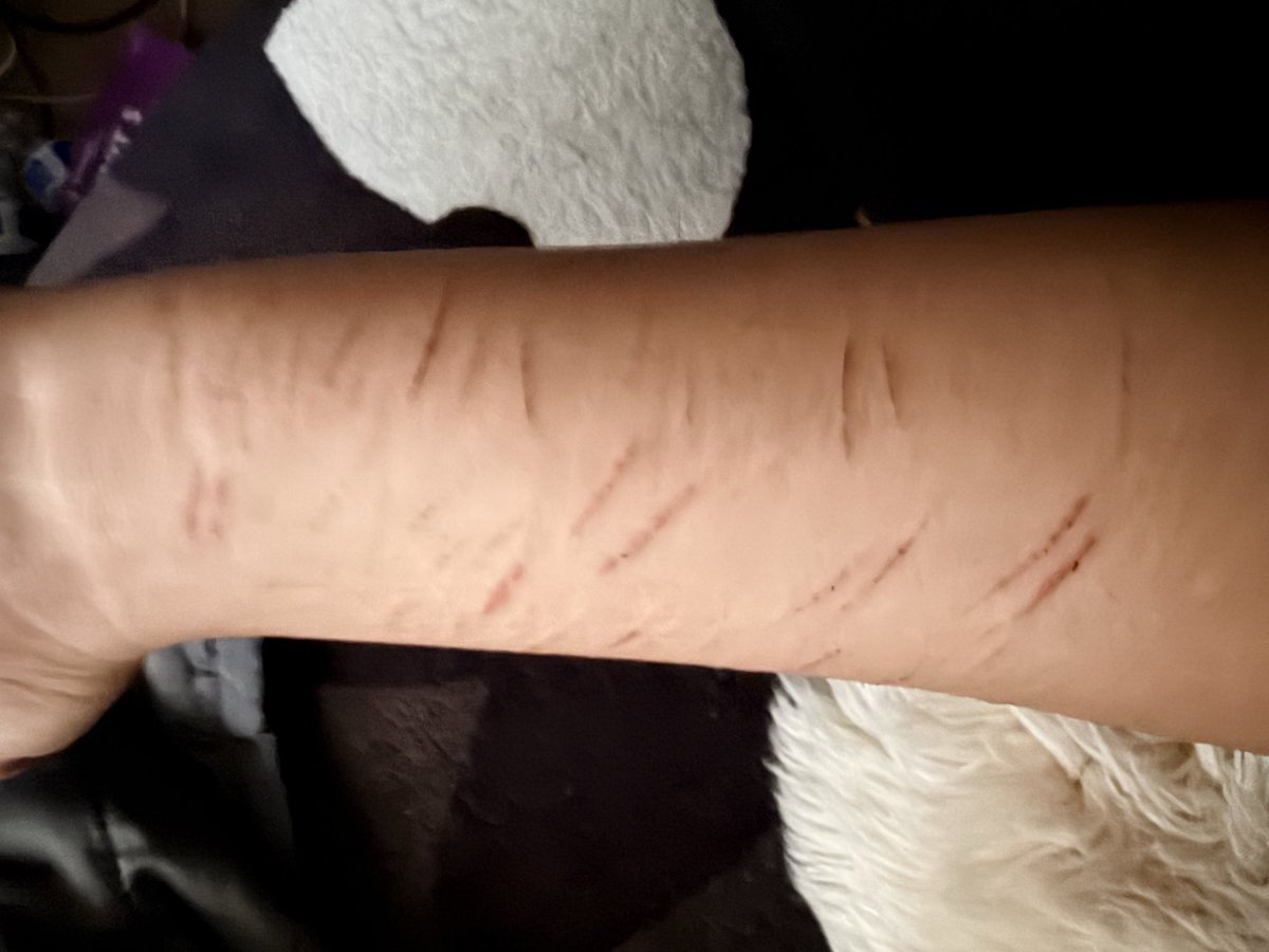 Mila_pinkie's tweet photo. Hello! First post on this (>w< )always! Any tips on how to go deeper! Or get money by doing this? Anything helps #shtwt #cuting #fakeblood Also these are pussy cuts so send tips to go deeper without hurting that much (ᗒᗣᗕ)՞ https://t.co/QwobJk5Ja1