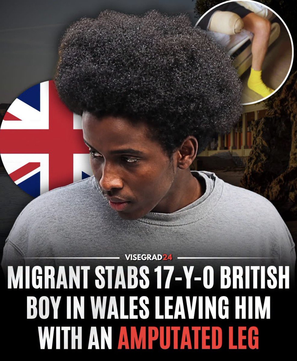 TruthFairy131's tweet photo. 🇬🇧 A 17-year-old British boy has had his lower leg amputated after being stabbed by migrant Idris Ahmed, 18, during the bank holiday weekend at Barry Island in Wales. 

Follow @Visgrad24 https://t.co/FdvDq7HRQ8