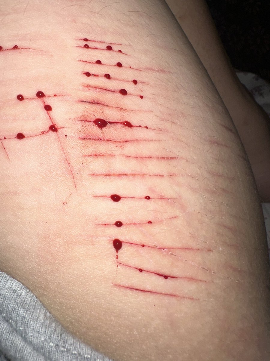 Andrew_fucElonM's tweet photo. “Looks like the cat did a number on you” god forbid my cat is severely homophobic bruh (I’m so back guys) #shtwt #shedtwt #slittwt https://t.co/m2R4icjK71