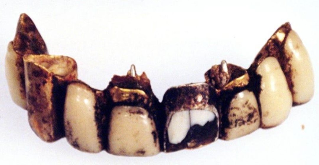 figamak's tweet photo. @JonDoe279718 @wh0_0uyM @austinwarner155 @DarkOddCon They literally found his jaw, and it matches the 1944 X-ray. Cope harder https://t.co/t5D5XbdxFy