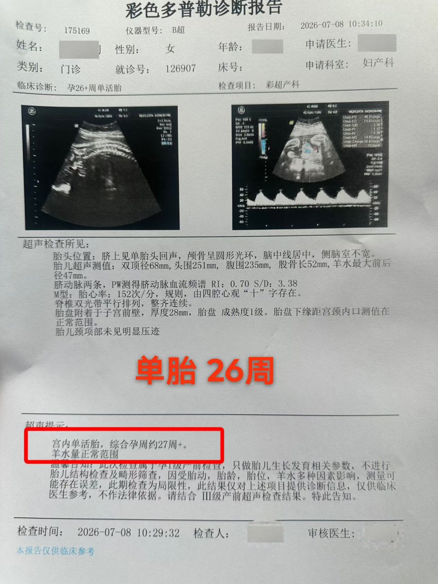 vkingchou's tweet photo. 👩‍🍼日常产检护航记👩‍🍼
📆16w-37w不等👶👶👶
👥单胎&amp;双胎齐聚👭
💖一切正常，安心待产💖
咨询请+微信:-ivf188188
#夫夫分卵 #代孕 #龙凤胎 #0风险包成功 #hiv洗精 #三代试管 #选性别 #不孕不育#包成功 #a卵b怀 #拉拉 #les https://t.co/w6VEjBwvgZ