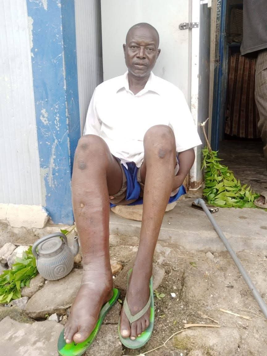 MujahidSSaad's tweet photo. The man you see here is our former teacher at Government Science Secondary School, Gusau — Malam Muhammad Liman, popularly known as Malam Game.

He has recently been afflicted with a serious illness. Due to financial hardship, he can no longer afford to remain in the hospital, and his condition has left him facing a very difficult situation.

As someone who dedicated his time to educating and guiding us during our school years, we are appealing to kind-hearted individuals, friends, former students, and the general public to support him so he can receive proper medical treatment and care.
For more information or to contact him, please call: 08167270869.

For those who wish to support Malam financially, his bank details are:

Bank: Polaris Bank
Account Number: 1767115519
Account Name: Muhammad Liman Anka

May Allah grant him a speedy recovery, reward everyone who extends a helping hand, and bless us all with the compassion to support one another in times of need.