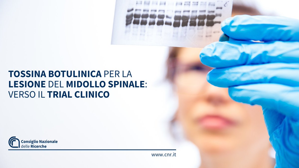 CNRsocial_'s tweet photo. Tossina botulinica per la lesione del midollo spinale: verso il trial clinico
Studio @Cnr_Ibbc dimostra che può:
➖ridurre neuroinfiammazione
➕favorire riparazione tessuto nervoso 
➖attenuare dolore neuropatico
Per approfondire👇
https://t.co/HEETyJH5bO https://t.co/E3ujonn2ex