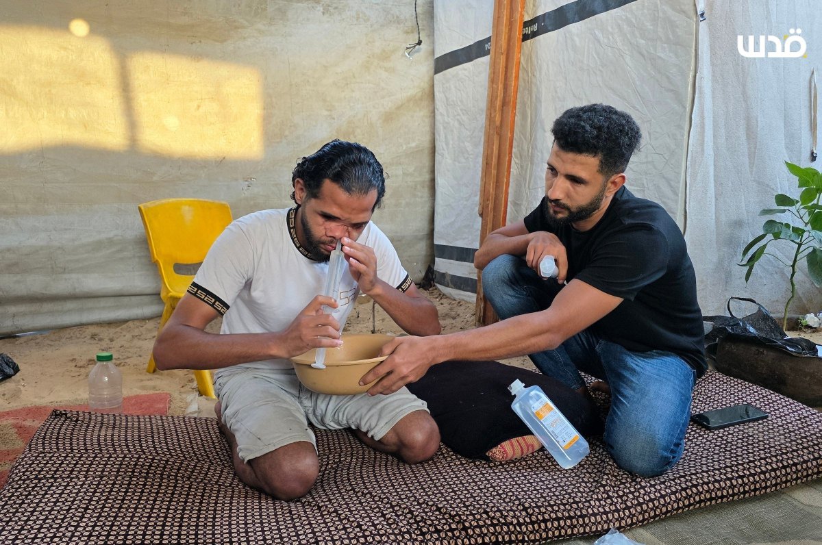 qudsn's tweet photo. الشقيقان محمد دبور وموسى دبور يعيشان داخل خيمة نزوح في خانيونس، بعد إصابتهما برصاص الاحتلال بمركز لتوزيع المساعدات في يوليو 2025 استشهد فيها شقيقهما حسين.

 يأمل الشقيقان في السفر خارج القطاع لتلقي العلاج. https://t.co/mwD7CM0cxi