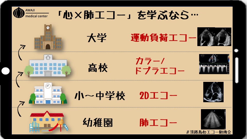 jun_awaji's tweet photo. 📌 #淡路島心エコー勉強会
心エコーの習得は、図のような流れが一番理想です

肺エコー始まりである必要は、実際ないと思いますが… 
"即戦力"と"簡単さ"という点で早めに習得するメリットは大きいと思います。 https://t.co/PfwRJ5t8pI