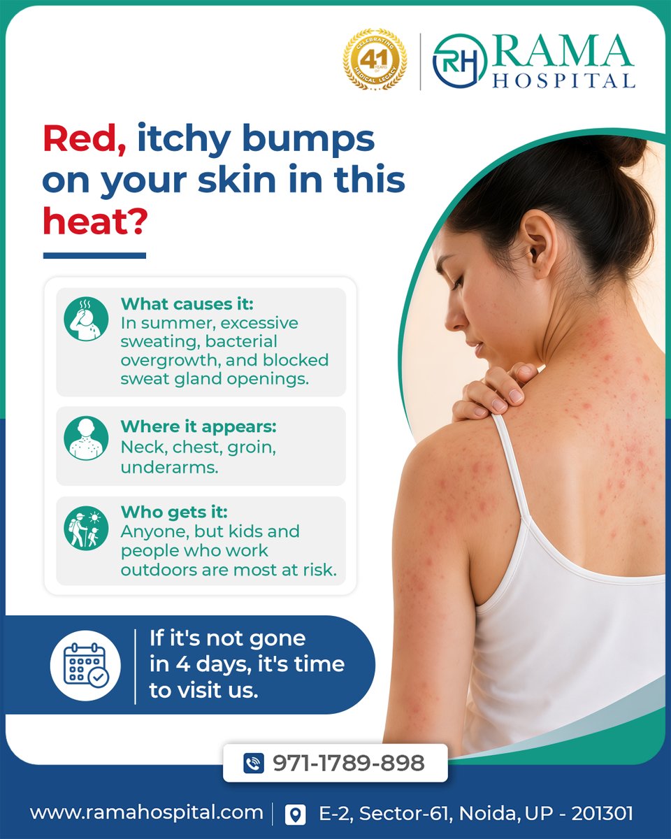 RamaHospital_RH's tweet photo. Red. Itchy. Bumpy. Heat rash?
 Neck. Chest. Underarms. Groin.  Persistent?
 Don't guess.  

Rama Hospital Dermatology. 📞 971-178-9898  
Sector-61, Noida 
 Book your consultation 
Today:https://t.co/YjtiicJdKj  

#RamaHospital  #Bestdermatologistinnoida #Multispecialtyhospital https://t.co/NB1bqN7Frv