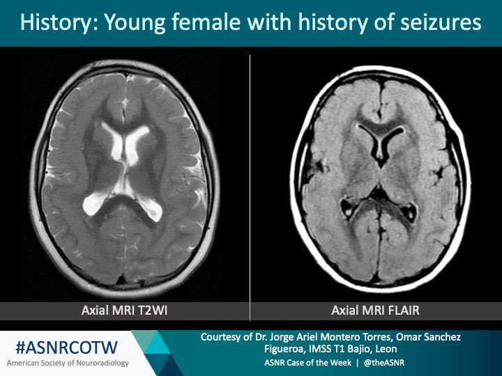 The American Society of Neuroradiology tweet media