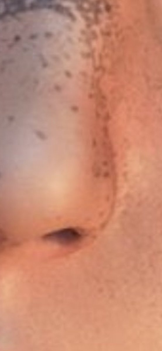 SynnysterVirgin's tweet photo. @_Natlanna_ @MightyCroft There are 66,000 pixels on her left nostril, 12,000 pixels on her upper right front tooth. And the patch of skin covered in my diaper contents have 3,000 pixels. My little bird is so hard when I zoom in to her features. I don’t want a job https://t.co/ImzTEx2kdw