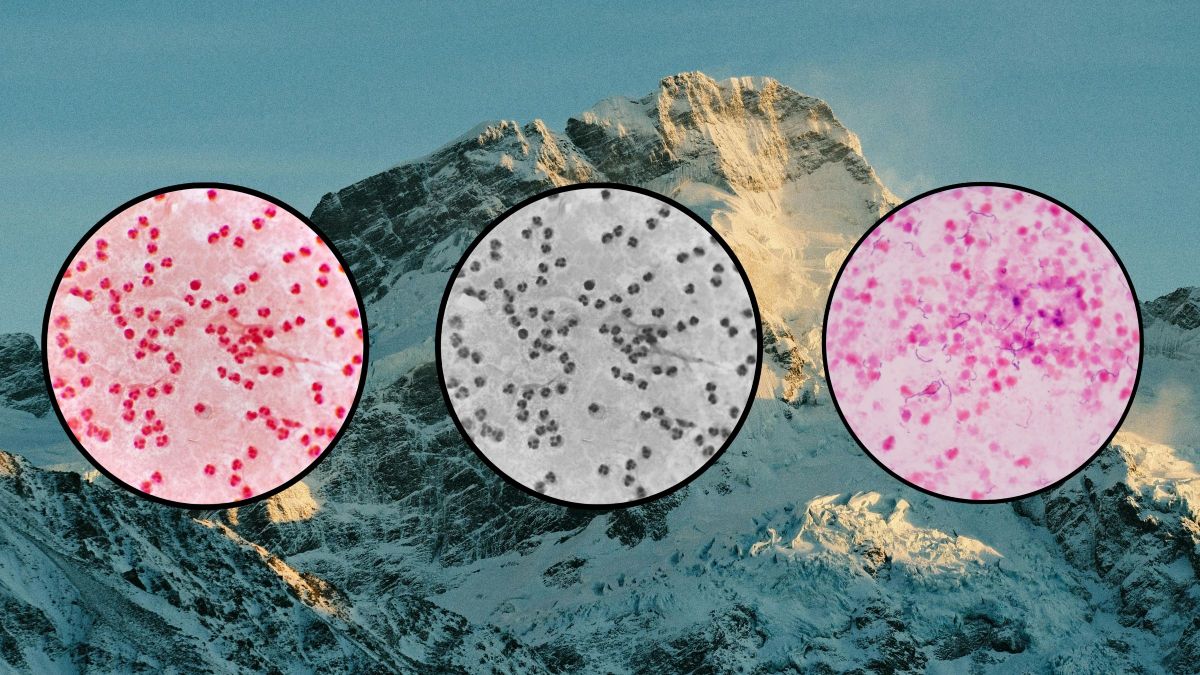 outsidemagazine's tweet photo. The bacteria living in your gastrointestinal tract may play a surprising role in how much altitude sickness affects you. https://t.co/a6JLjVnb7Z https://t.co/kbFObTX9nh