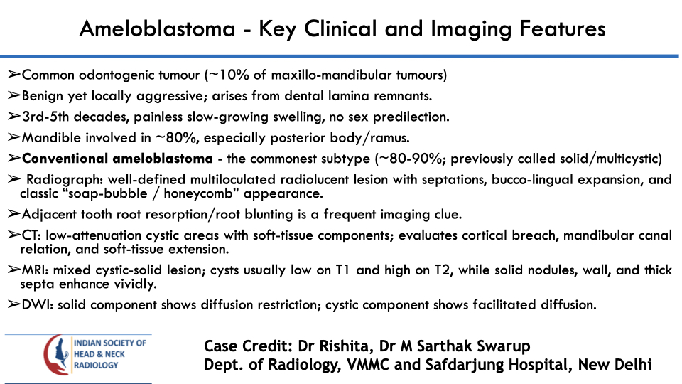 teamishnr's tweet photo. #caseoftheweekanswer

Please find the answer
#radiology #caseoftheweek #headandneck #radiologycases #dailywork #ISHNR #teaching #research #imaging #FOAM #FOAMRad #FOAMMed

Visit our website: https://t.co/rgh521JNBP
All Cases: https://t.co/0xaPvoBy5H https://t.co/y7vpMX6Uz8