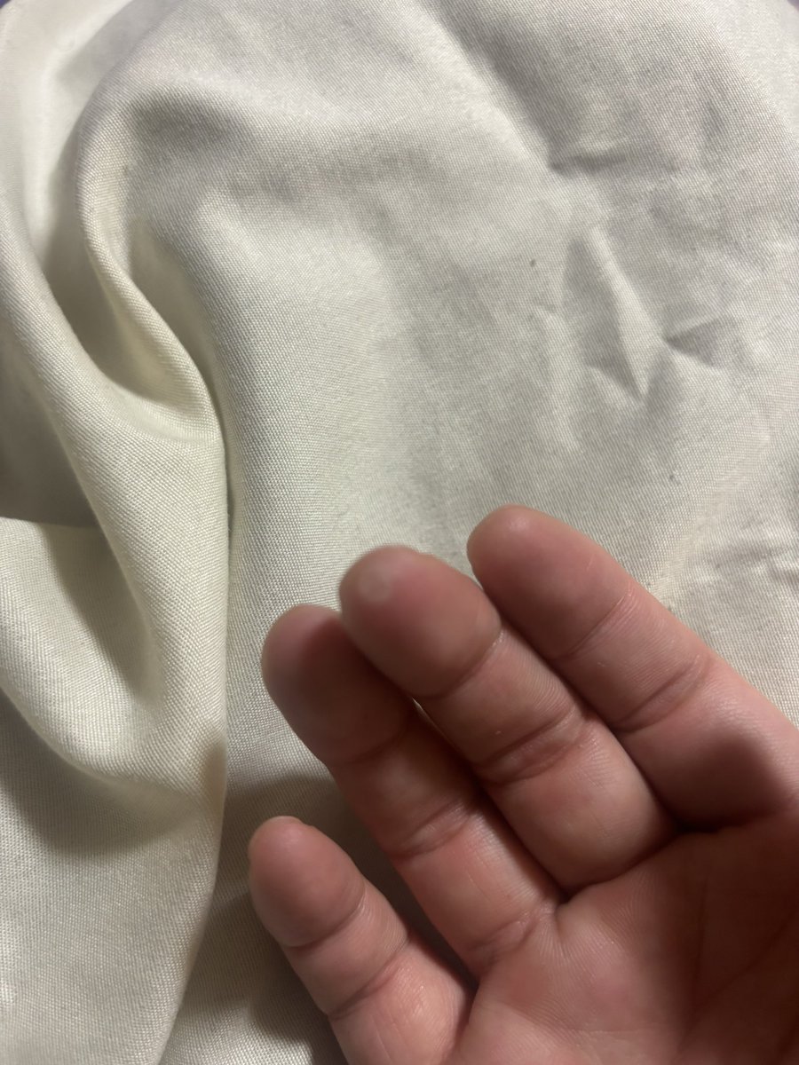 paz_Gt_1925's tweet photo. 風邪が長引いて定時なのでギターを弾きまくるのである。右手の中指に水ぶくれできたのである。 https://t.co/LefPEFhxVF