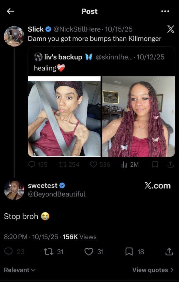 Pinkpillempire's tweet photo. @BeyondBeautiful Fuck you and your la Frederic hoe😂 https://t.co/ebHbyYn3uG