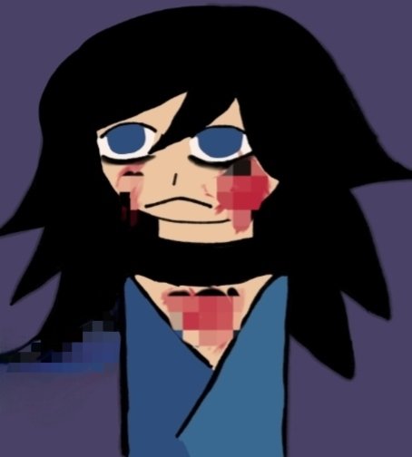 SLURLUDAYS's tweet photo. The blood portion has been pixelated... https://t.co/dtqpsWL0qz