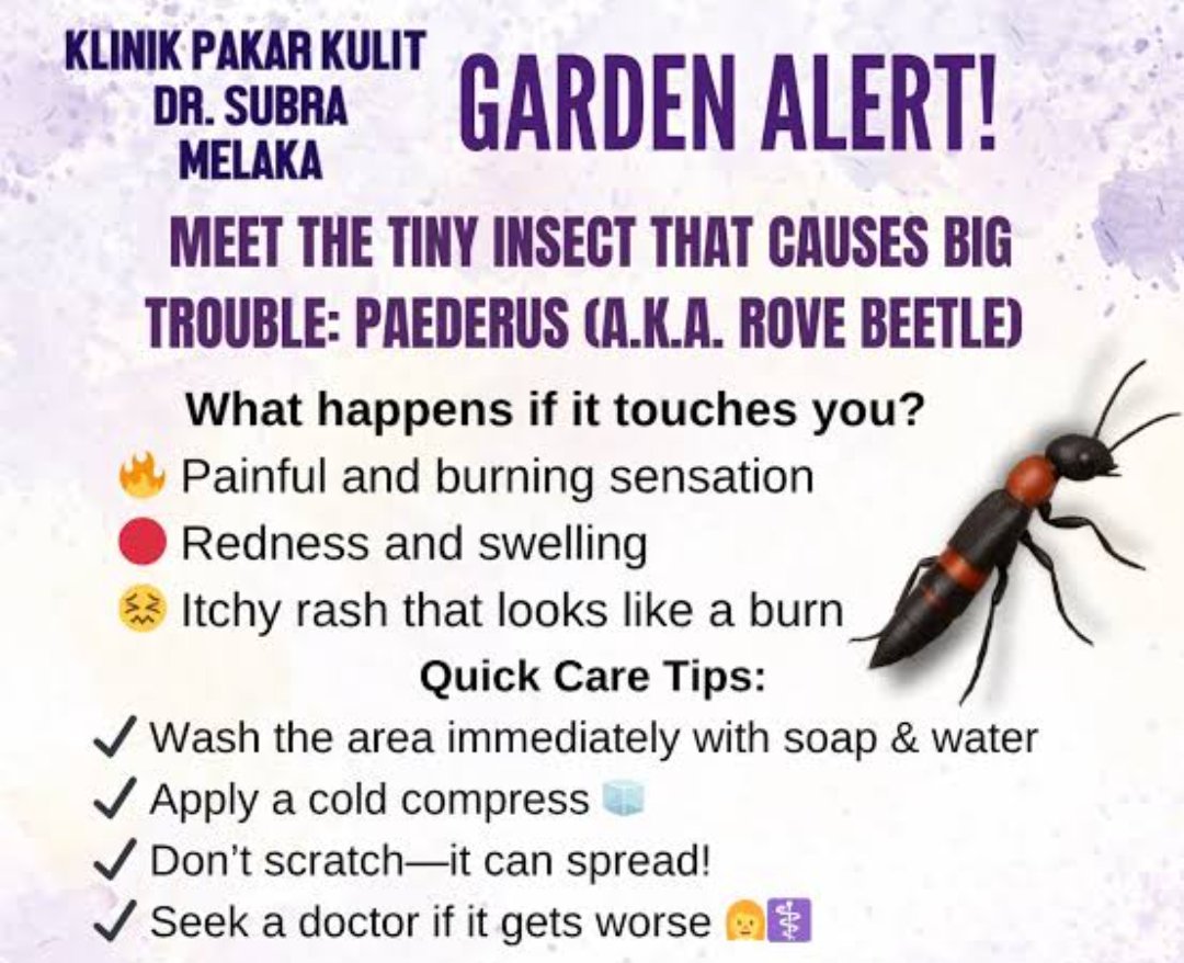 raviennees's tweet photo. @cozyyperson26 It's called tomcat on my country but pretty sure it's called "Paederus beetle" in English, it doesn't bite or sting but touching it can release toxin, like the one on your hands, the toxin called pederin https://t.co/qtmLByec94