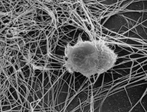 humanimmunenews's tweet photo. Interested in #DendriticCell diversity and dysfunction in #cancer?
This #review highlights recent insights into this area, focusing on emerging DC-targeted strategies to enhance immunotherapy.
Learn more: https://t.co/Zk35V8CeMO https://t.co/Ol7JXHadsd