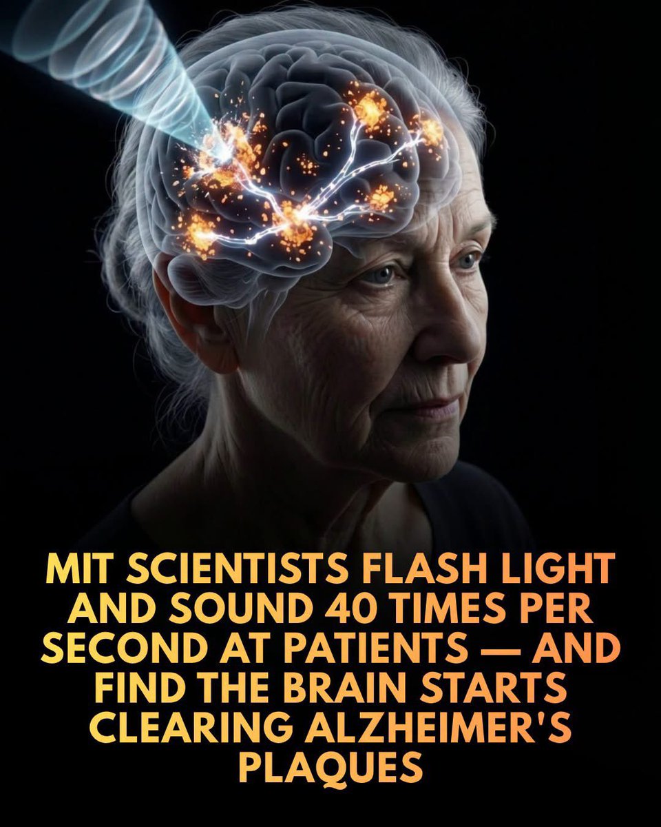 ShiningScience's tweet photo. A new Alzheimer’s treatment uses 40 Hz light and sound pulses to trigger the brain’s natural waste-disposal system and flush out toxic proteins.

Recent breakthroughs in neuroscience have revealed that exposing the brain to light and sound flashing exactly 40 times per second—a method known as 40 Hz gamma stimulation—can significantly boost natural brain waves associated with memory, attention, and cognitive processing. 

In numerous animal studies, this rhythmic sensory stimulation successfully prompted the brain to clear away amyloid and tau, the hallmark proteins driving Alzheimer's disease. Rather than relying on traditional pharmaceuticals to target these plaques, this cutting-edge approach activates the glymphatic system—the brain's internal 'plumbing'—to naturally flush out harmful waste and preserve connections between neurons.

The therapy's promise is already extending to human clinical trials. Patients with Alzheimer's who underwent regular 40 Hz sensory stimulation showed slower rates of brain shrinkage and notable cognitive improvements compared to untreated control groups. While researchers emphasize that this experimental technique is not a cure and a large-scale Phase III nationwide trial is currently underway to prove its definitive clinical efficacy, the paradigm shift is profound. By harnessing the brain's own rhythms to trigger self-repair, scientists hope this non-invasive approach might eventually be adapted to treat other complex neurological conditions, including Parkinson's disease, stroke, and multiple sclerosis.

source: Orenstein, D. Evidence that 40Hz gamma stimulation promotes brain health is expanding. MIT News.