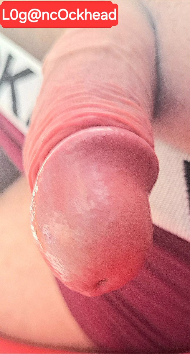 Loganc0ckhead2's tweet photo. 我巨大粉紅色的蘑菇，看起來漂亮又美味嗎？🍄✨大到連醫療圈都埋進去不見了。天生就割好包皮喔。你心裡一定很想再看近一點吧？😏💕對像女孩子一樣可愛的你，特別讓你看看喔。 https://t.co/YpA8zwawSX
