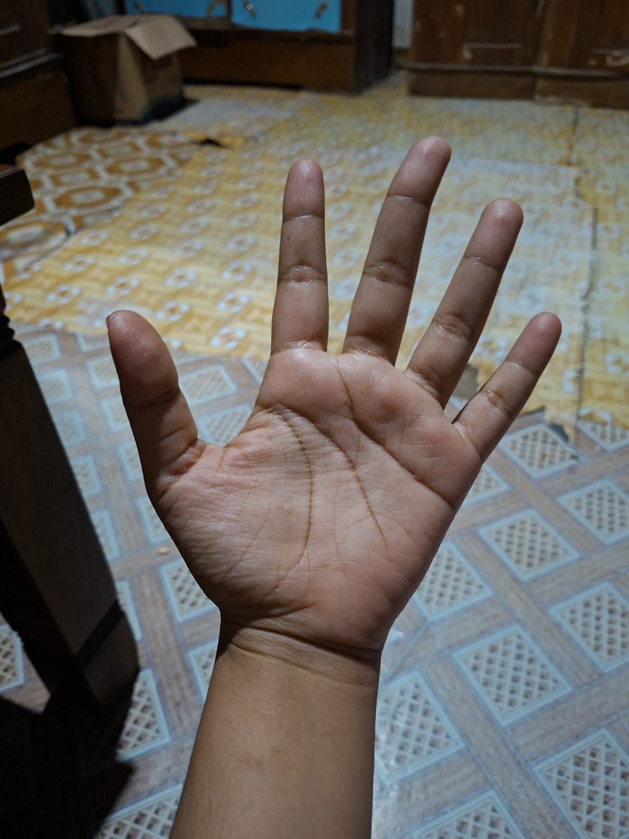 cupliskucing's tweet photo. Kadang bikin salfok, kalau kulit telapak tangan aku itu tebel banget jadi empuk (sering di suruh mijitin ortu dapet imbalan 10k wkwk) 

Terus ya garis tangannya tuh kelihatan jelas banget, kadang pengen punya tangan girly kaya ciwi ciwi yang lain😅 https://t.co/VzASctM0Td