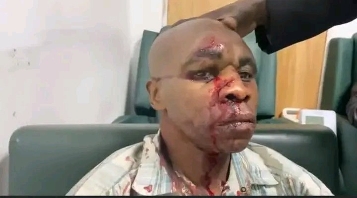VictorKith's tweet photo. #Kinshasa : Le cortège de l'opposant @MartinFayulu a été attaqué à la machette devant le ministère de la Justice après l'appel de la coalition #C64 à marcher le 22 juillet contre la révision #constitutionnelle.
#Lamuka accuse la #Force_du_progrès (UDPS). Bilan : 3 blessés graves. https://t.co/InP453wm2V