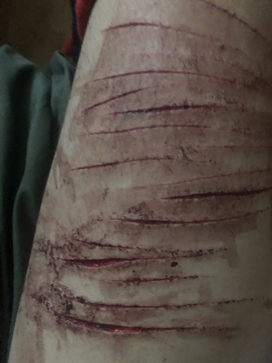 Pppppppphixyob's tweet photo. I slitmythighs yesterday ONLY STYRO ONE SWIPES cause my shit is getting dull (this is an ai generated image using search engine AI) https://t.co/bOd9jvwCQm