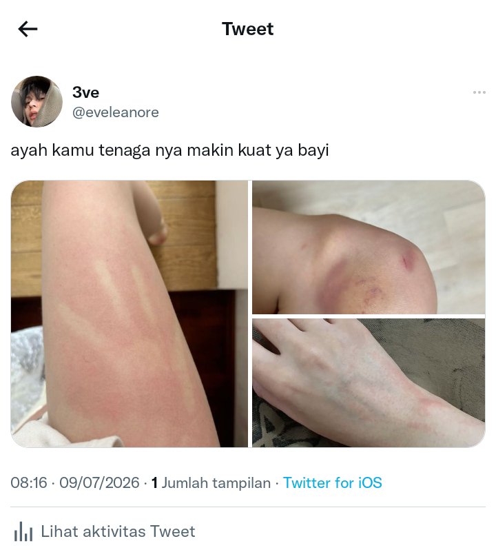 jewellerhy's tweet photo. #tones au — i'm yours (2) 
WARN: MPREG, Toxic Relationship https://t.co/LYLshjuF0Q