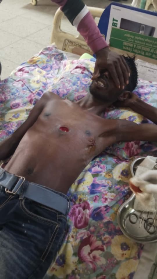 humanvb7p's tweet photo. Nuru Islam is fighting a severe lung infection. After treatment at Rangpur Medical College, he urgently needs to be moved to Dhaka Chest Hospital. 
Your small support can save a life. 📧 humanfirstleaguefoundation@gmail.com
#HumanityFirstLeague #MedicalAppeal #EmergencyRelief https://t.co/FCxWncl7xm