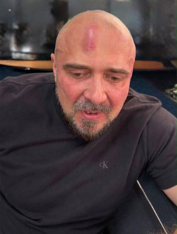 EgenyBuchy's tweet photo. Працівники СБУ побили у власній оселі першого заступника директора “Української Бронетехніки”, - заява компанії https://t.co/PDmvjoB46p