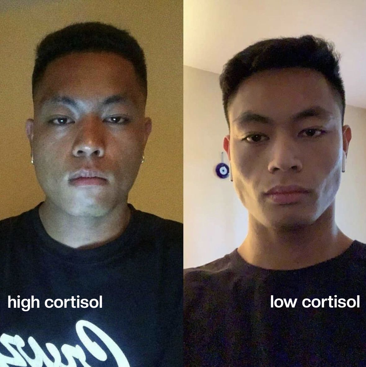 IdeaBravaX's tweet photo. El cortisol es una de las razones por la que no puedes reducir tu grasa facial.  

Estas son las mejores maneras de reducirlo.  

#1 Come más potasio https://t.co/4ePRIXyFB1