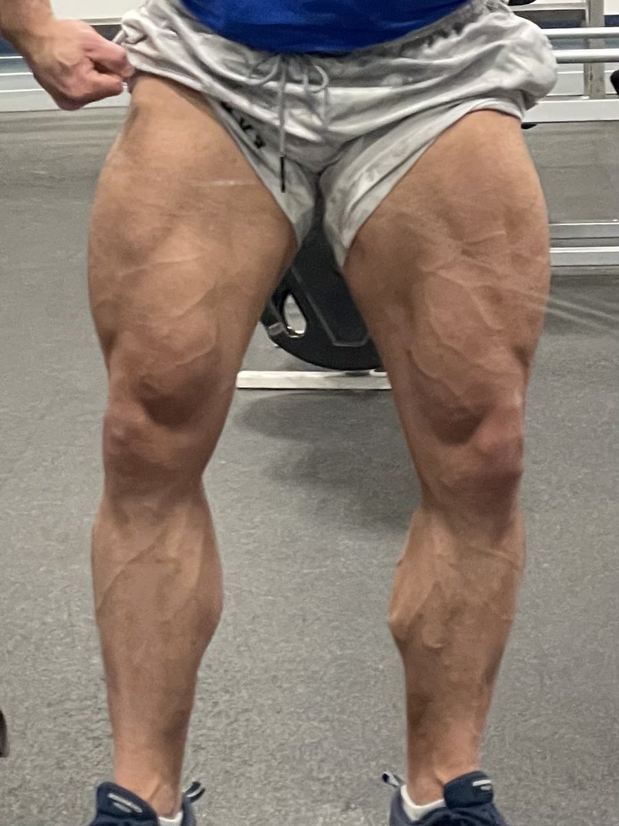 jayd3cwv's tweet photo. Since starting bodybuilding, legs have been one of my weakest areas, and I’m determined to make them one of my strengths. Really happy with how they’ve progressed this summer and fall (even through this cut)😤 https://t.co/a92dnZhV5R