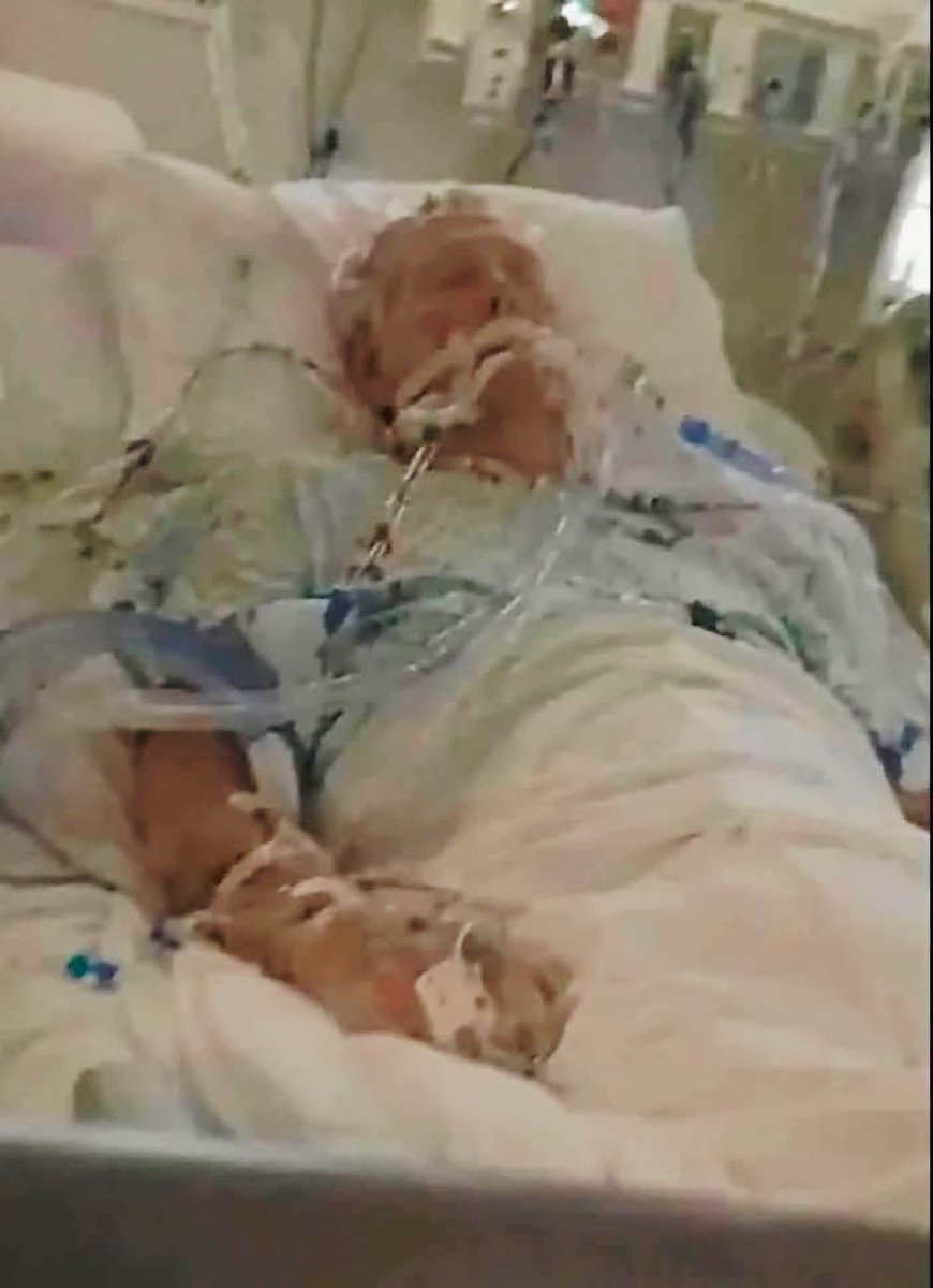 GeminiCane05's tweet photo. @HalfwayPost ''His voice was strong, seemed upbeat &amp; his health is improving.'' -Scott Jennings https://t.co/JOgMmx7om8