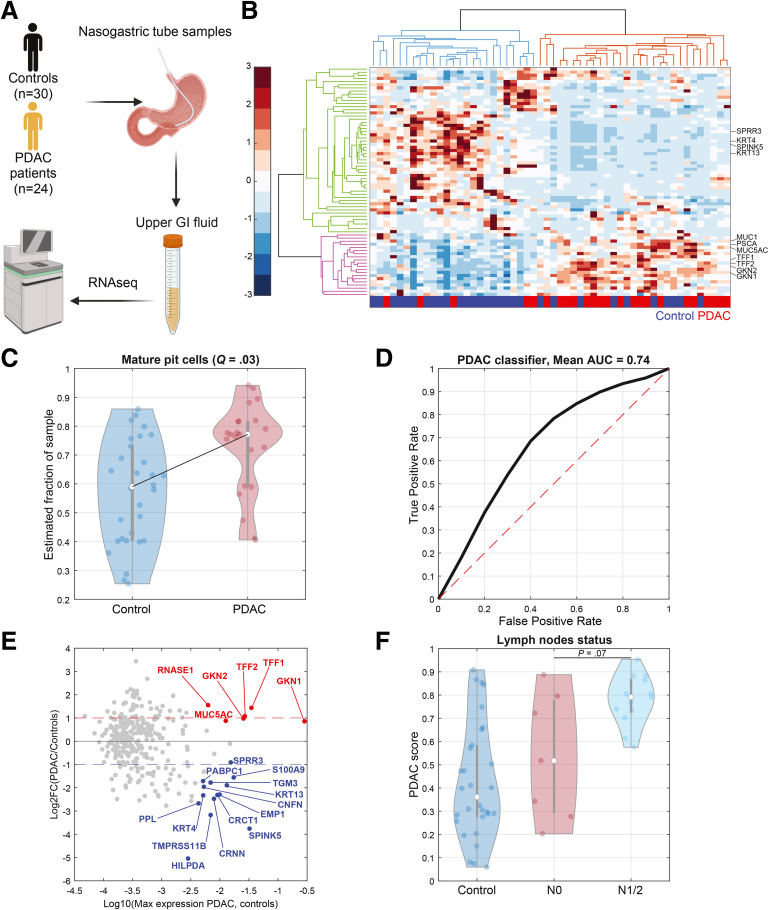 AGA_CMGH's tweet photo. ✉️ Check out this research letter ➡️ "Transcriptomics of Upper Gastrointestinal Fluids Can Diagnose Pancreatic Ductal Adenocarcinoma" 🔗 https://t.co/I5c9TIiibp 🏷️ #ResearchLetter #GIHealth https://t.co/4aalVKZiFV