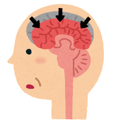 ploplojuly's tweet photo. 🧠 暑さは脳にも影響する？酷暑が認知機能や判断力を低下させる理由【医学的基礎編】を公開！👉https://t.co/XyxalYY8cV https://t.co/oLxwaILPrE