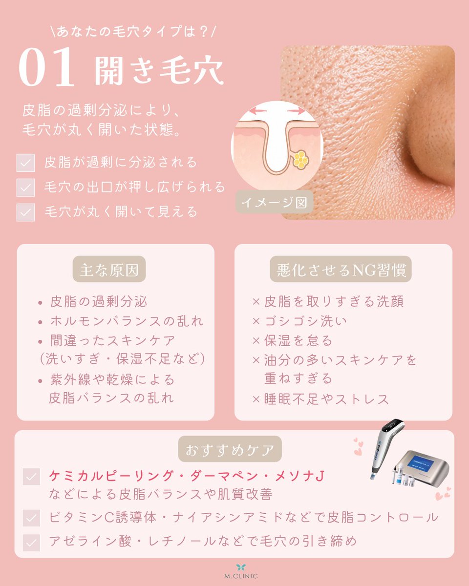 mcli_official's tweet photo. 【保存推奨】毛穴悩みは、実はタイプによって原因もケア方法も違います💡

✔ 開き毛穴
✔ 黒ずみ毛穴
✔ 詰まり毛穴
✔ たるみ毛穴

あなたはどのタイプ？

今回は、それぞれの特徴とおすすめのケア方法をまとめました✨
ぜひ最後までチェックしてみてください😊

#美容皮膚科 #スキンケア #美容医療 https://t.co/V0zbJuE0DR