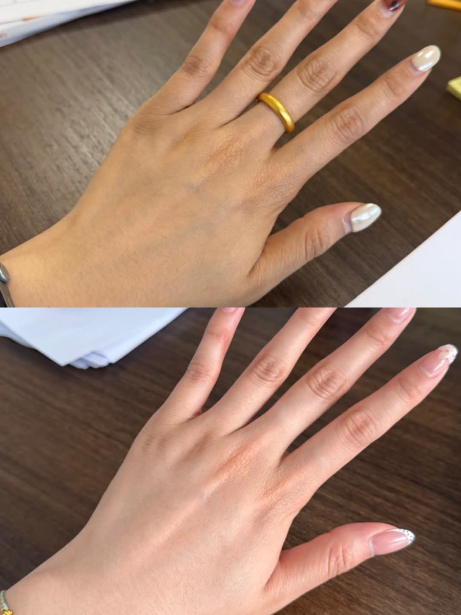 faradistyy's tweet photo. Ga pernah ngira kalo bakal sengaruh ini minum combo swisse, tau gitu kenapa gak dari dulu aja sihhh🤣￼ https://t.co/Uvi6MUWuTl