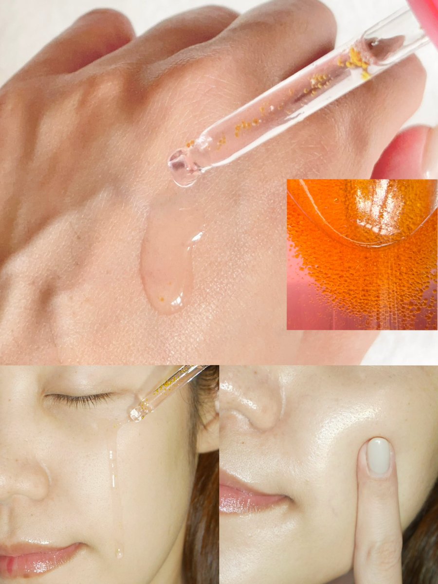 PangLReview's tweet photo. อีกหนึ่งเซรั่มที่ใช้ประจำในตอนนี้ จะเป็นตัว TXA Niacinamide 10 Retinal Serum เค้าเป็นเซรั่มที่รวม 3 ส่วนผสมหลักอย่าง
✔️Tranexamic Acid : ช่วยยับยั้งการเกิดเม็ดสีเมลานีน
✔️Niacinamide : ช่วยปรับสีผิวให้สม่ำเสมอขึ้น
✔️Retinal Capsules : ช่วยลดเลือนจุดด่างดำ ที่ทำได้มากกว่าเรตินอลทั่วไปถึง 11 เท่า
เรียกว่าเป็น Triple Active for dark spots ที่ยกระดับการดูแลผิว จบปัญหาฝ้า กระ และริ้วรอยในหนึ่งเดียว
หลังจากลองใช้มาสักพักใหญ่ๆ รู้สึกว่าผิวดูสม่ำเสมอขึ้น ผิวดูชุ่มชื้นขึ้นด้วย แนะนำเลย เพราะเหมาะทุกสภาพผิว
ส่วนวิธีใช้ ก็ขย่าขวด 3-5 ครั้ง หยด dropper แล้วนวดวนบนผิวให้ทั่วใบหน้าลำคอ หลังจากเซรั่มซึมดีแล้วก็ลงตัวบำรุงตัวอื่นๆต่อได้เลย สามารถใช้ได้ทั้งเช้า-เย็น แต่ถ้าตอนเช้าควรทากันแดดเน้นๆ เพื่อปกป้องผิวจากแสงแดดด้วยนะคะ 
#PuritoThailand #PuritoSeoulTH