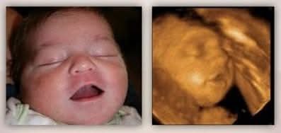 ProLifeBrother's tweet photo. Ultrasound Before &amp; After.
#ProLife #ProLifeGen #ChooseLife https://t.co/g7vsDTgEdA