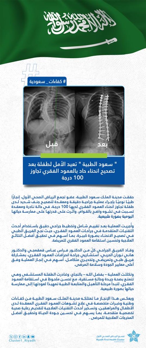 Cluster1_Riyadh's tweet photo. ️ 🗞️ | بعد مع��ناتها من انحناء حاد بالعمود الفقري تجاوز 100 درجة.. نجاح طبي بمدينة الملك سعود الطبية، عضو #تجمع_الرياض_الصحي_الأول، يعيد الأمل لطفلة ويُمكنها من بد�� مرحلة جديدة نحو حياة أكثر جودة https://t.co/WT3DhHfwFI