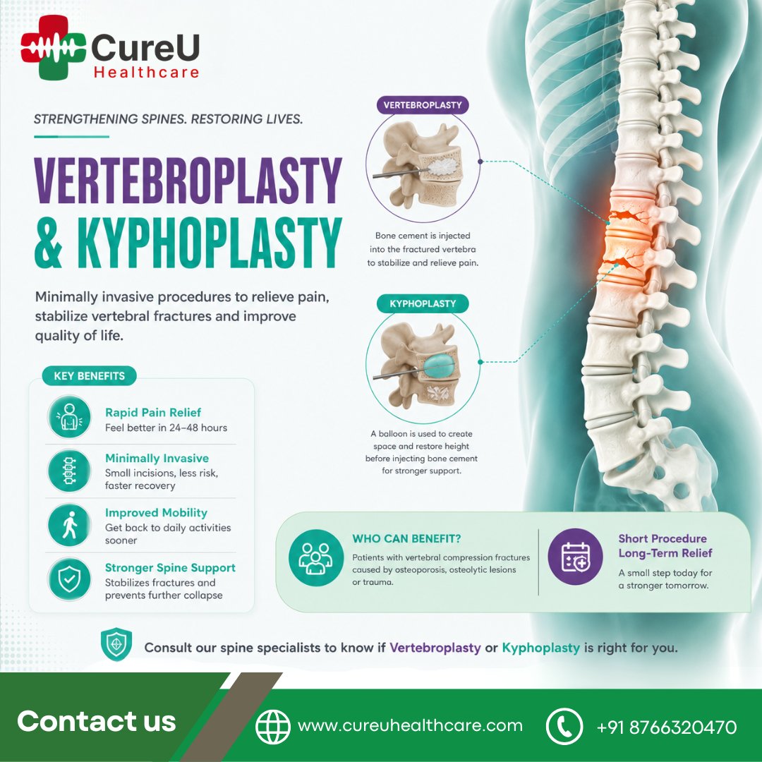 cureU_official's tweet photo. Back pain from a spinal compression fracture? 🦴

Vertebroplasty &amp; Kyphoplasty are minimally invasive procedures that help relieve pain, stabilize fractures, and restore mobility.

Consult the spine experts at CureU Healthcare.

#SpineCare #Vertebroplasty #Kyphoplasty #BackPain https://t.co/BaoIilmocj
