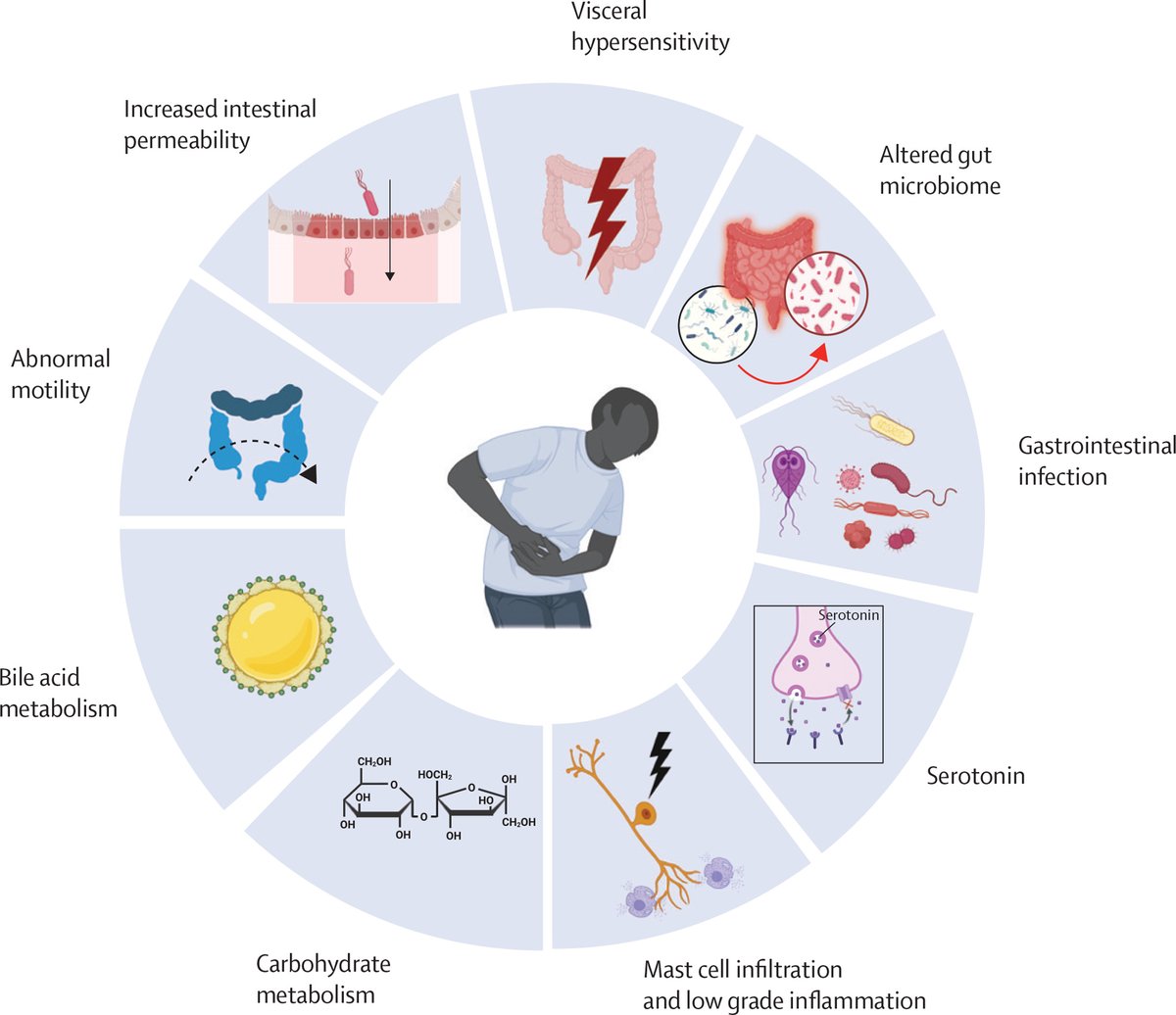 TheLancet's tweet photo. Irritable bowel syndrome (IBS) affects 5–10% of people worldwide.

In @LancetGastroHep, authors discuss the current understanding of the pathophysiology of IBS in terms of peripheral, central, and integrated mechanisms.

Read now: https://t.co/Y8YwCVdnhl https://t.co/fAi6Mg2Rcl