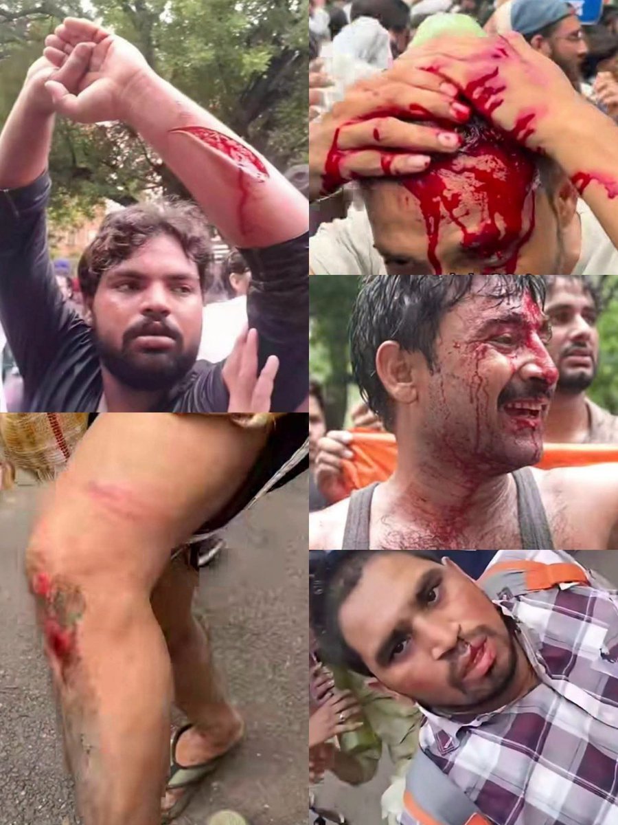 LalanSinha_'s tweet photo. लश्कर भी तुम्हारा है, सरदार तुम्हारा है, तुम झुठ को सच लिख दो अखबार तुम्हारा है!
इस दौर के फरियादी जायें तो कहाँ जायें, कानून तुम्हारा है, दरबार तुम्हारा है!

इतना मत डराओ की डरना छोड़ दे ,

जुल्मी जुल्म करेगा सत्ता के गलियारों से, चप्पा-चप्पा गूंज उठेगा इंकलाब के नारों से! https://t.co/lSmxFocrm7