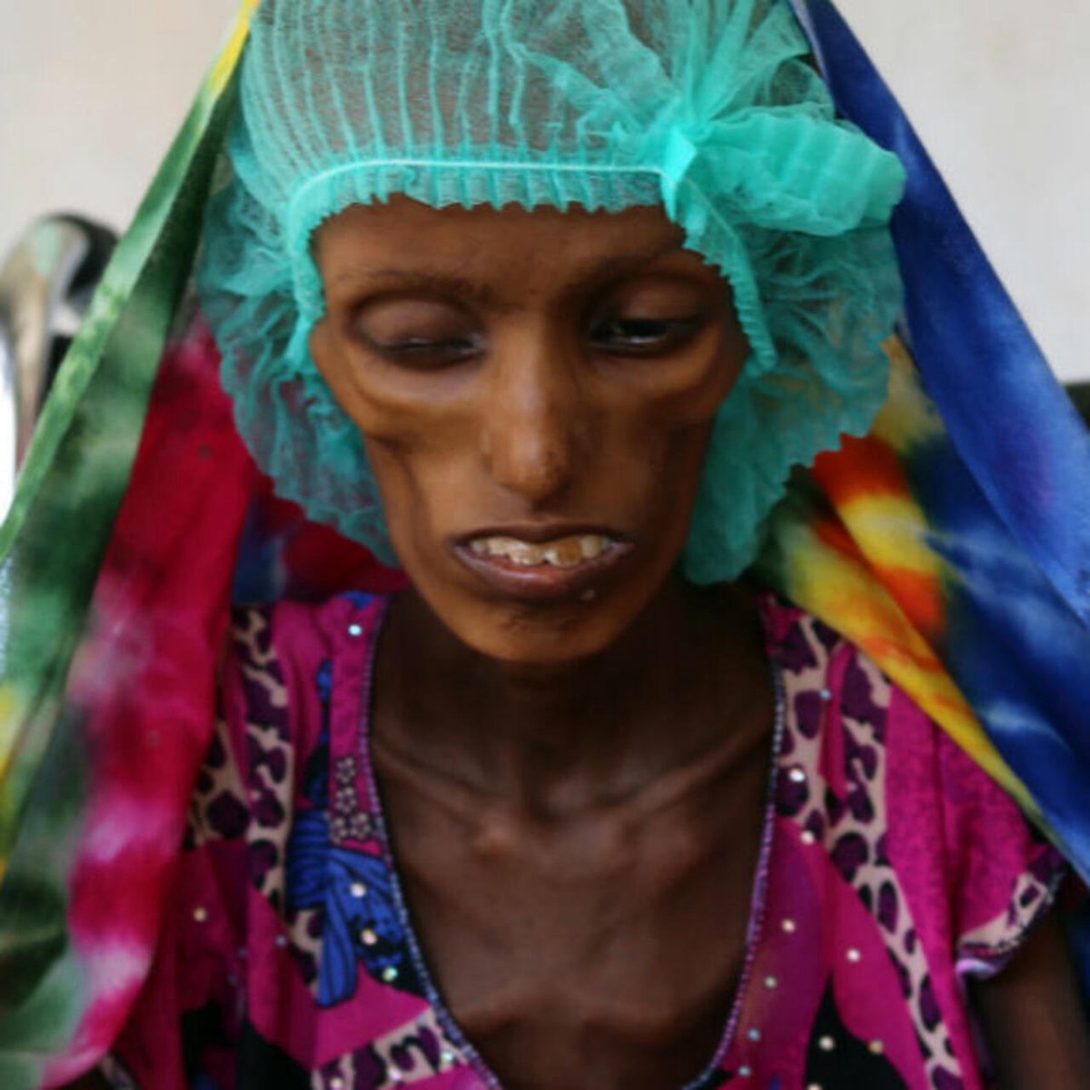 alainpaulweber's tweet photo. 2 famines, 2 ambiances 😢😢

Photo 1 : famine à Gaza
Photo 2 : famine au Yémen https://t.co/vbuvQGQHhc