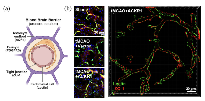 _JCBFM's tweet photo. 🚨 What if the blood–brain barrier isn't just a victim of stroke, but the bouncer? 🤔 🧠🚪
Endothelial ACKR1 helps keep inflammatory macrophages out, preserves BBB integrity, and improves long-term recovery after #Stroke.
#HotTopic🔗 1 month free: https://t.co/QCEyOoYk8V https://t.co/y2DdRRnENU