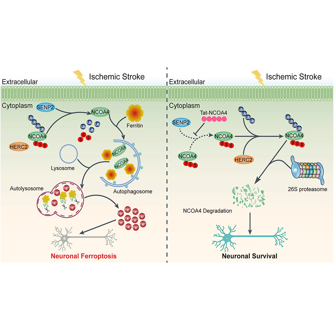 GenesNDiseases's tweet photo. Discover a potential new target for #IschemicStroke therapy.
This study shows that disrupting the SENP2–NCOA4 axis suppresses #ferroptosis, reduces brain injury, and improves neurological recovery. #SUMOylation
#GenesAndDiseases: https://t.co/3L7IAFGuIB https://t.co/wjdLB1JMKw