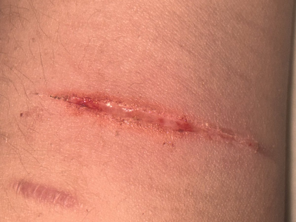 sqsxi's tweet photo. Scab picking owwie😢😢
(ALL FAKE) https://t.co/Ninn2FBHkA