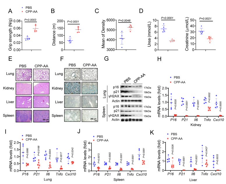cddpress's tweet photo. “Age-associated decline of Lamtor5 drives immunosenescence and systemic aging via cGAS-mediated paracrine inflammation”

This work establishes a mechanistic and functional connection between #InnateImmunity aging and systemic #Aging ⤵️
https://t.co/ivmV7z9l4G https://t.co/YLpajKriaY