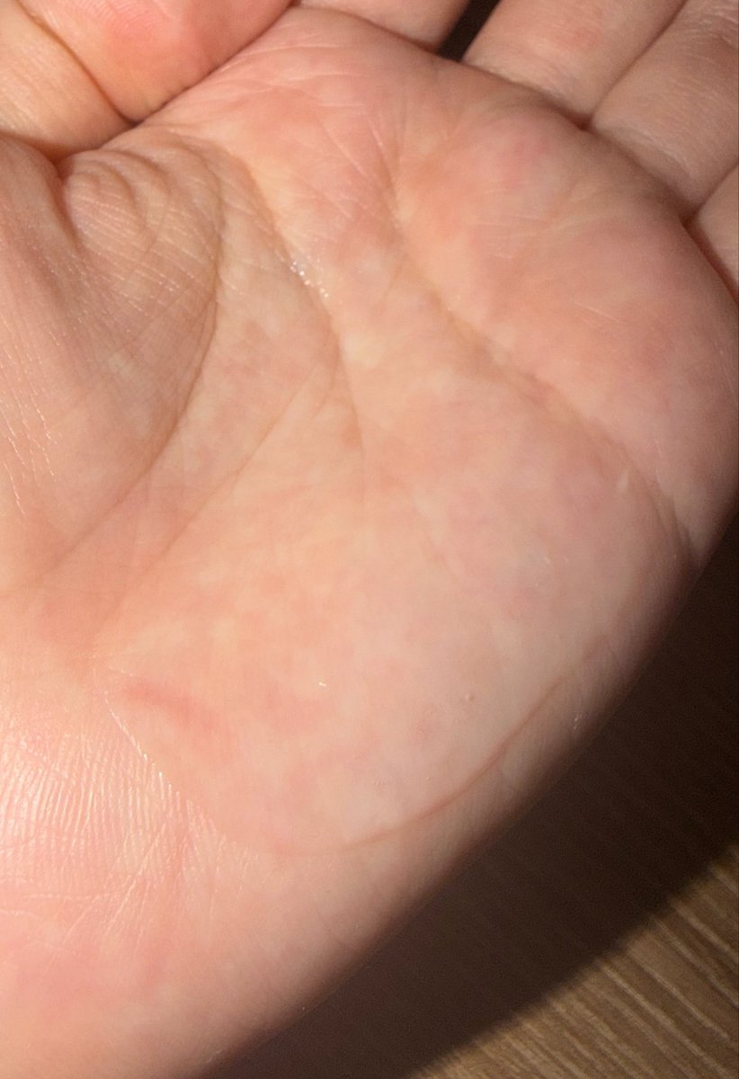 kaki_uni_'s tweet photo. iHerbで頼んでたビタミンC美容液届いた🥰
口コミでシミが薄くなったって書いてる人多かったから気になってたやつ🧐
目周りのシミに効くといいなぁ。 https://t.co/XGBp2joGKZ