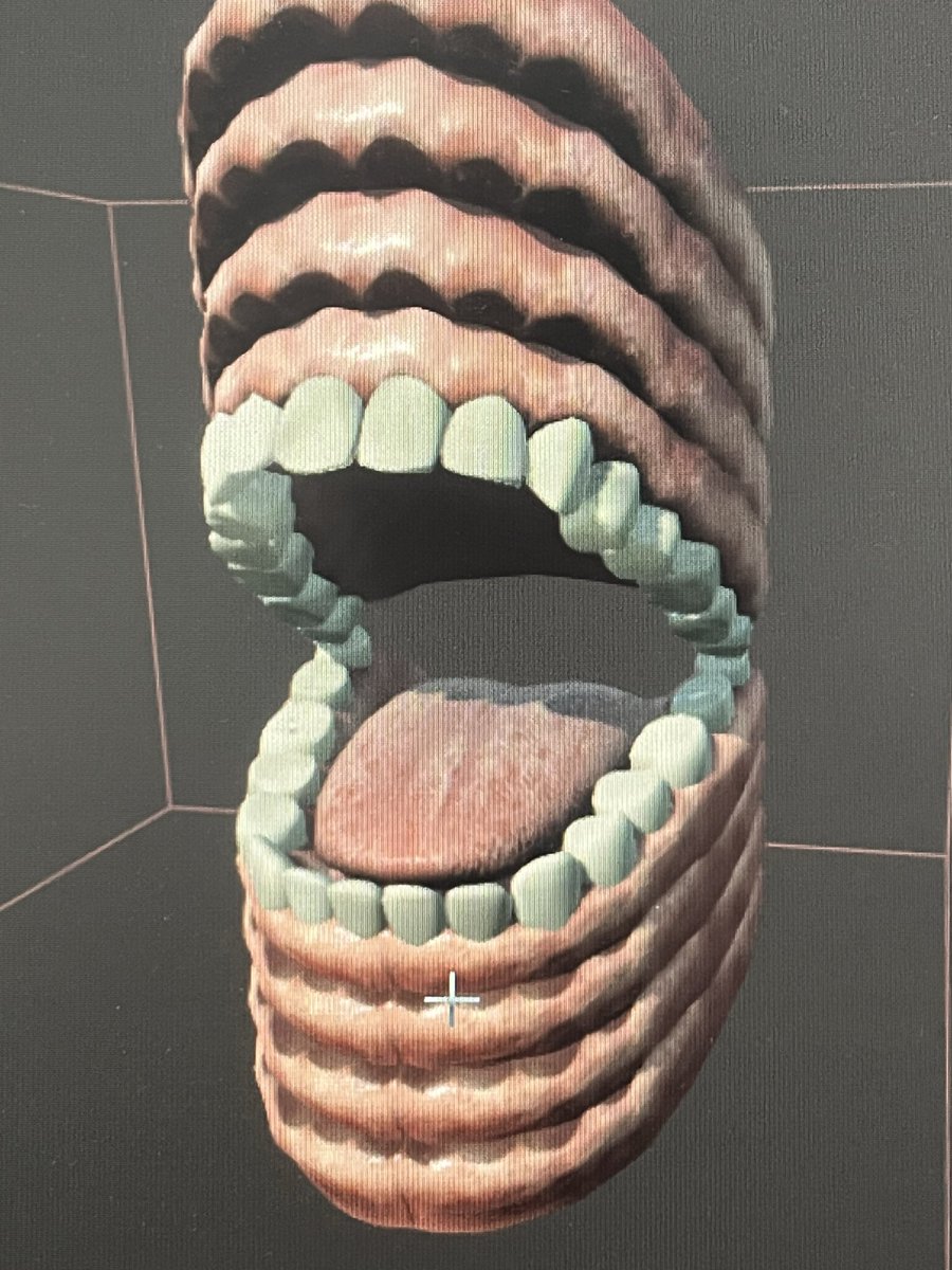 TAYUTACREATE's tweet photo. 一作目のホラゲーで作っていたエネミーの試作画像でてきた、ほぼ歯茎、、、

The enemy prototype from my first horror game was basically just a pair of gums. 

#gamedev #indiedev #steam #UnrealEngine #UE5 https://t.co/Le4pq22f6E