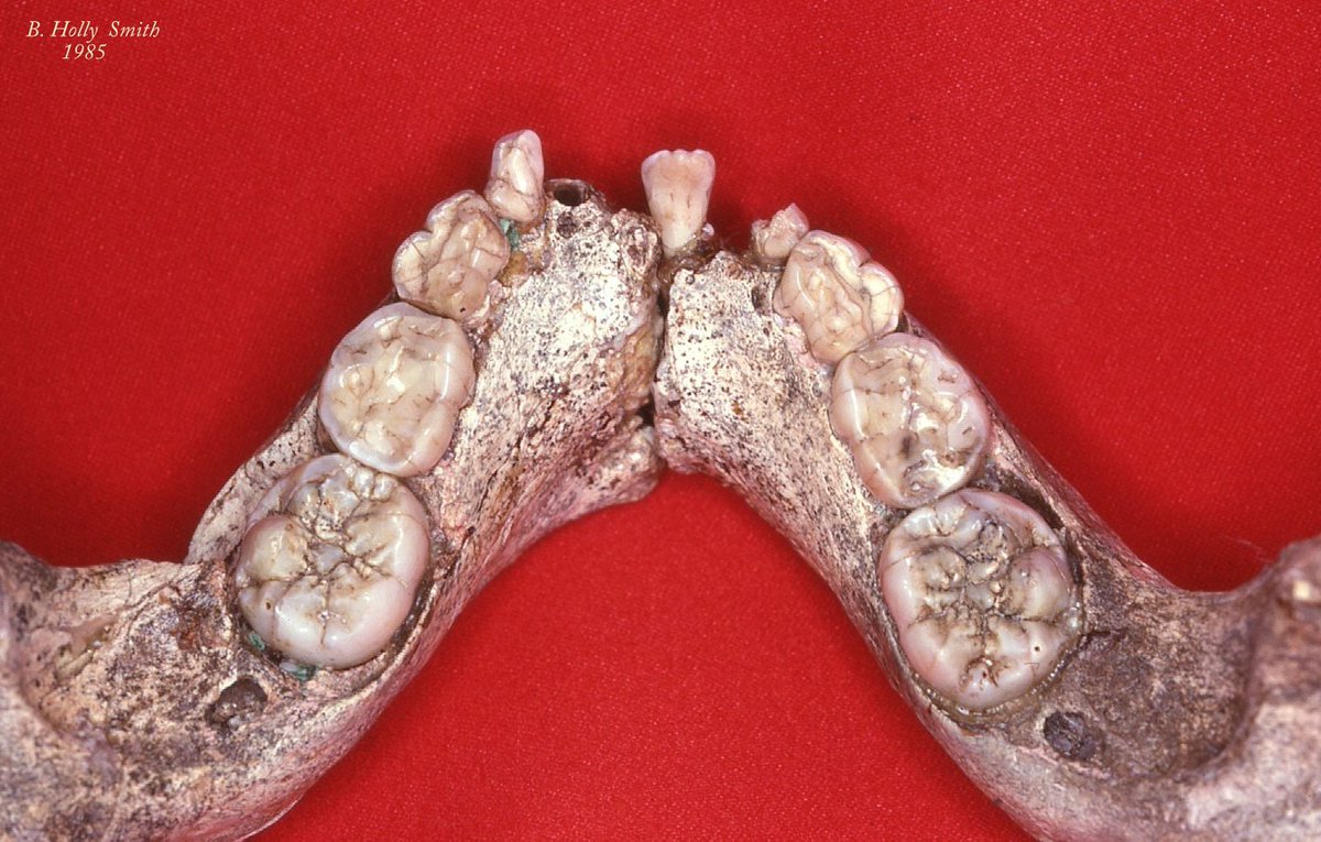 Biology_MDPI's tweet photo. ⭐️2024 Article by B. Holly Smith - published in Biology!
"Mammalian Life History: Weaning and Tooth Emergence in a Seasonal World"🐒🦷
🔖Citations: 10
🔭Views: 6111
🔗Full Paper: https://t.co/koBrFhEjWW
#Biology #Anthropology #Mammalia #Tooth #Fossils #LifeHistory #OpenAccess https://t.co/DIFbk2t5QY