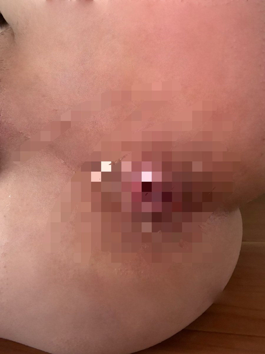 Hze5YMjNH264075's tweet photo. 肛門好きな人いる？ https://t.co/rc1lDvSLU3