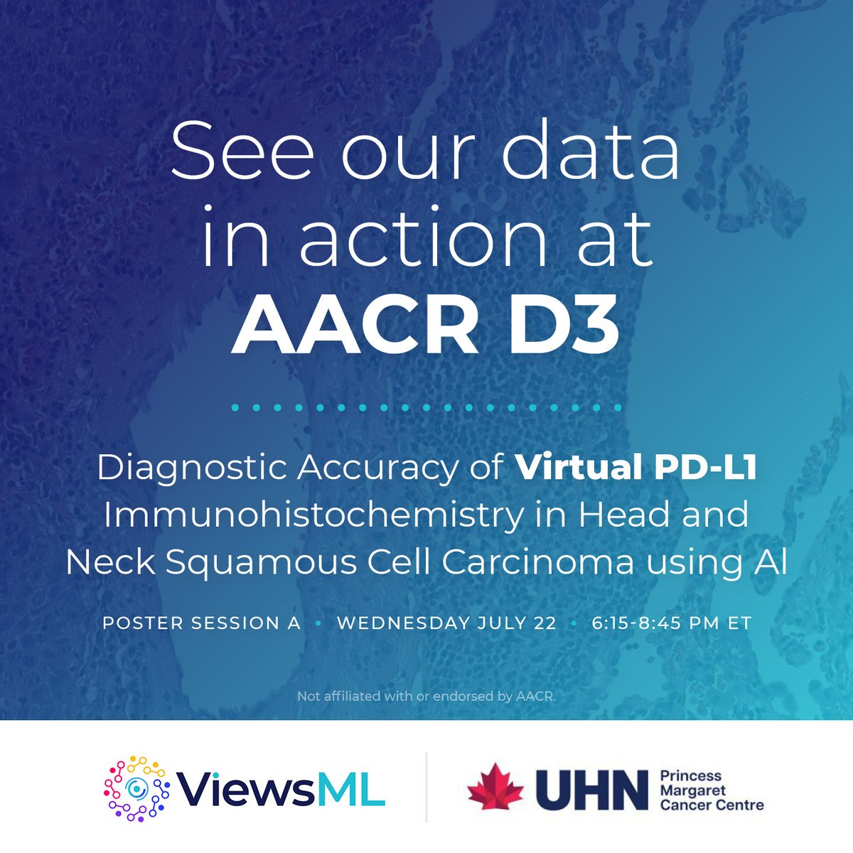 viewsML's tweet photo. Using ViewsML's data, @UHN’s @pmcancercentre validates AI-driven virtual PD-L1 immunohistochemistry for diagnostic accuracy. See us at the American Association for Cancer Research Drug Discovery and Development conference. https://t.co/U5E4uhwpFd https://t.co/Zx6xfLpNbu